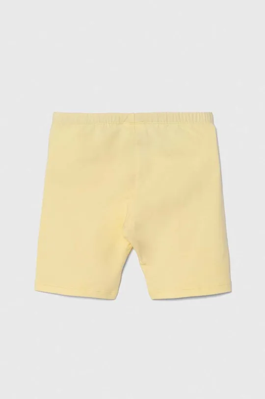 Otroške kratke hlače United Colors of Benetton rumena