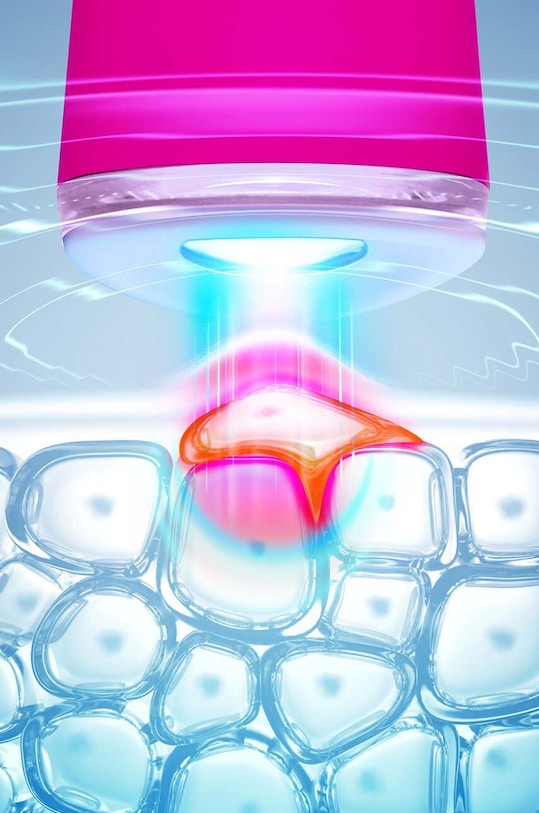 Пристрій для лікування висипань за допомогою синього світла led FOREO ESPADA™ F0288 фіолетовий