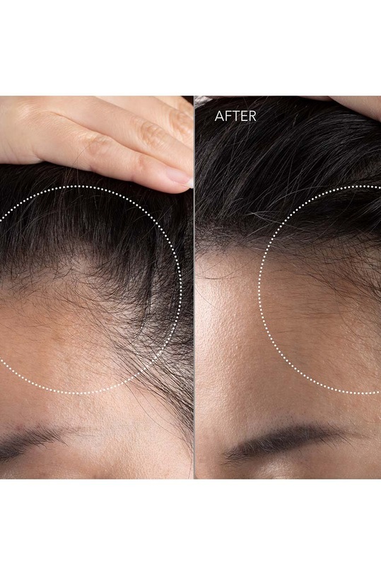 LED masážní přístroj na posílení vlasů FOREO FAQ 301 Blue Emerald F0273