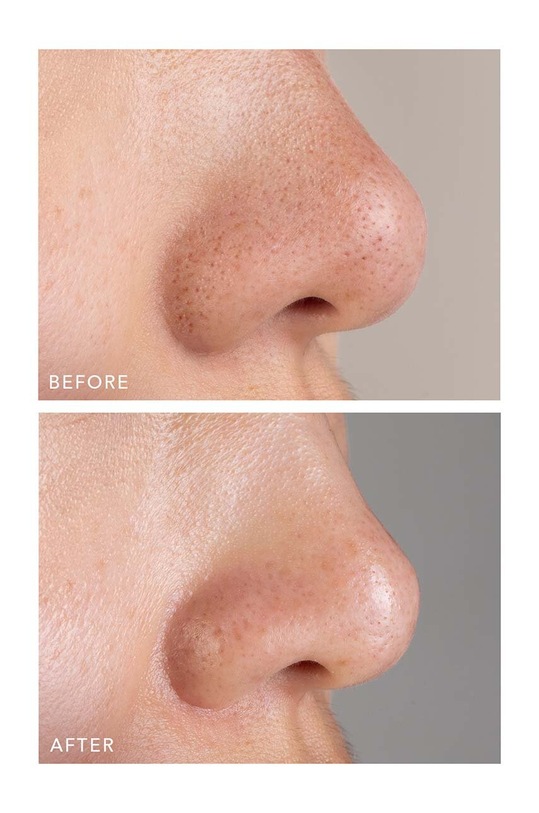 FOREO mască de argilă activă pentru puncte negre KIWI Active Pore & Blackhead Mask 100g F1931