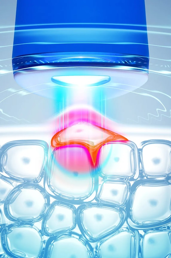FOREO dispositivo per il trattamento dell'acne con luce led blu ESPADA 2 Cobalt Blue F0538 multicolore