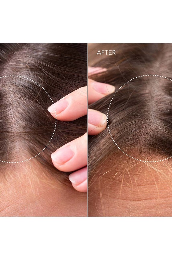 Προβιοτικός ορός για το τριχωτό της κεφαλής FOREO FAQ Scalp Recovery & Thick Hair Probiotic Serum 60mL F0365 πολύχρωμο