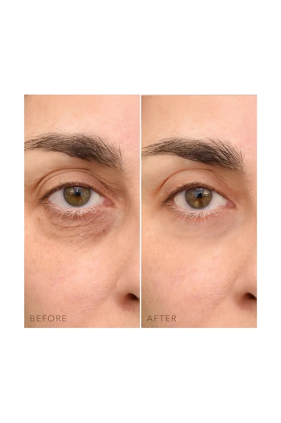 Koncentrovaný oční krém FOREO IRIS C-Concentrated Eye Cream 15 ml F0873.
