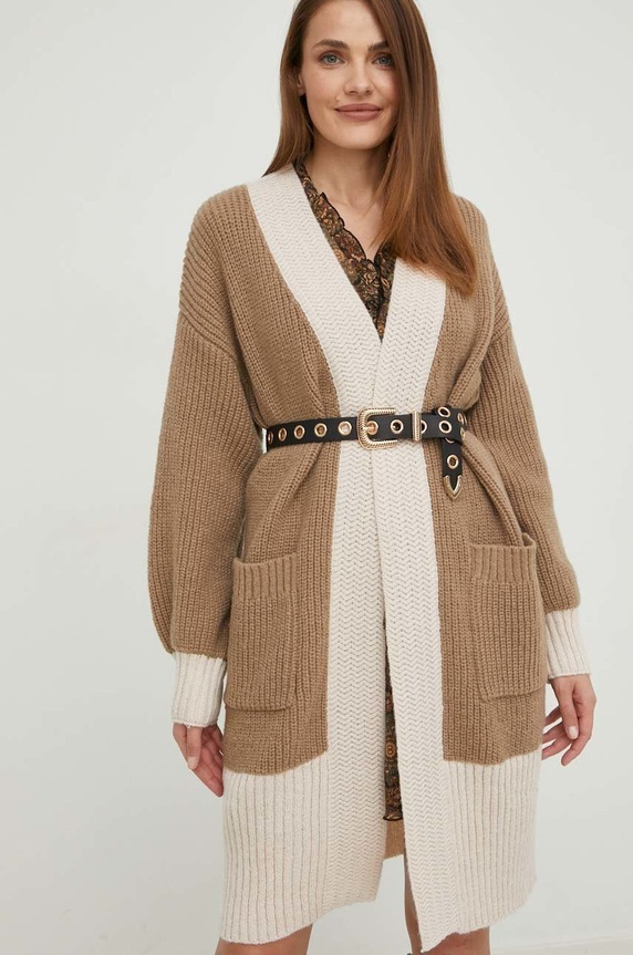 Answear Lab kardigán mintás bézs L1504.WK