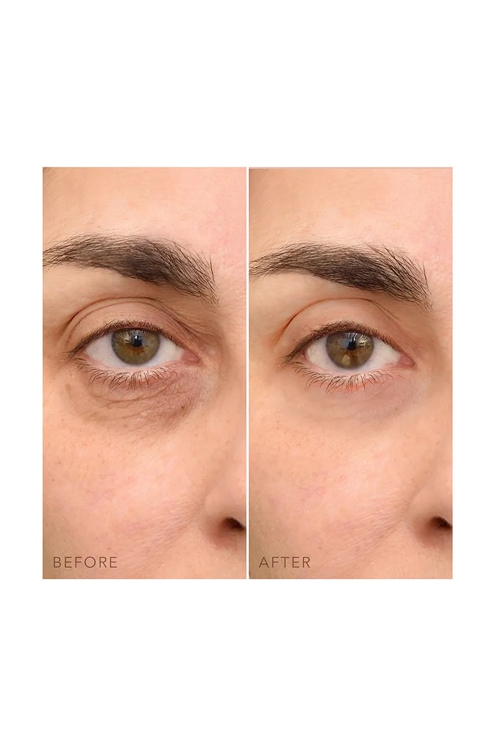 Koncentrovaný oční krém FOREO IRIS C-Concentrated Eye Cream 15 ml F0873.