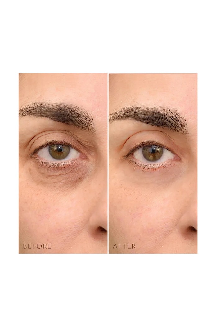 Koncentrovaný oční krém FOREO IRIS C-Concentrated Eye Cream 15 ml F0873.