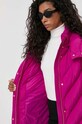 Pinko kurtka 101601.A11M