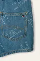 Tommy Hilfiger - Дитячі шорти 128-176 cm блакитний