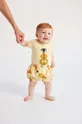 rumena Bombažne kratke hlače za dojenčke Bobo Choses Otroški