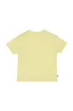 Kratka majica za dojenčka Tommy Hilfiger rumena