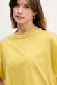 United Colors of Benetton t-shirt bawełniany żółty 3096D1071