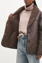 Куртка Answear.LAB 9255.ilk