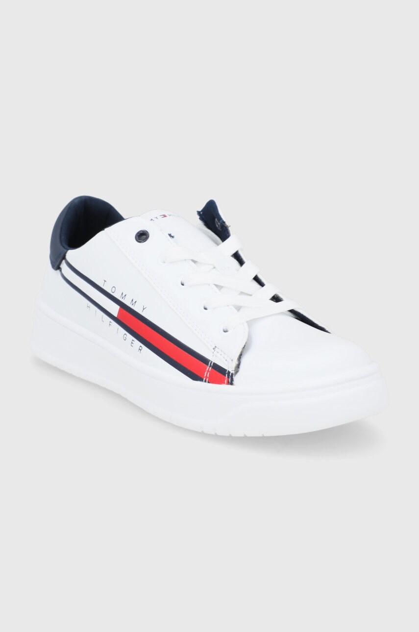 

Дитячі черевики Tommy Hilfiger колір білий
