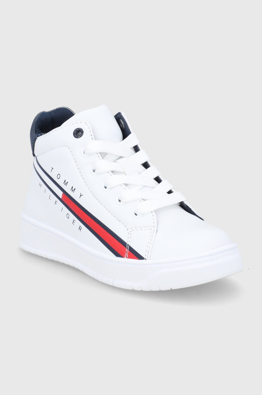 

Дитячі черевики Tommy Hilfiger колір білий