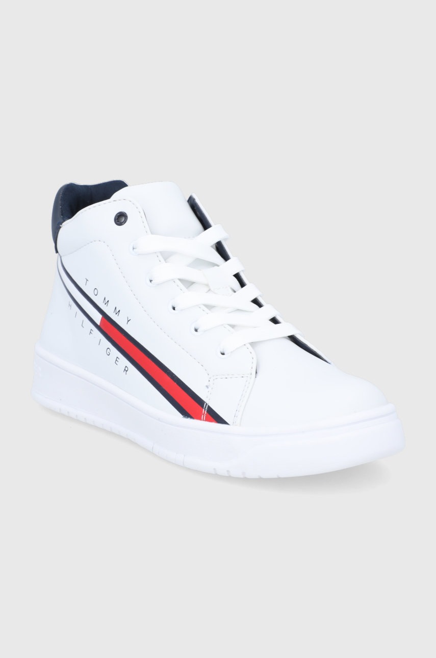 

Дитячі черевики Tommy Hilfiger колір білий