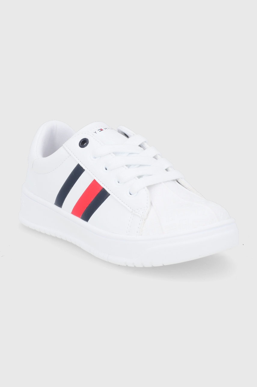 

Дитячі черевики Tommy Hilfiger колір білий