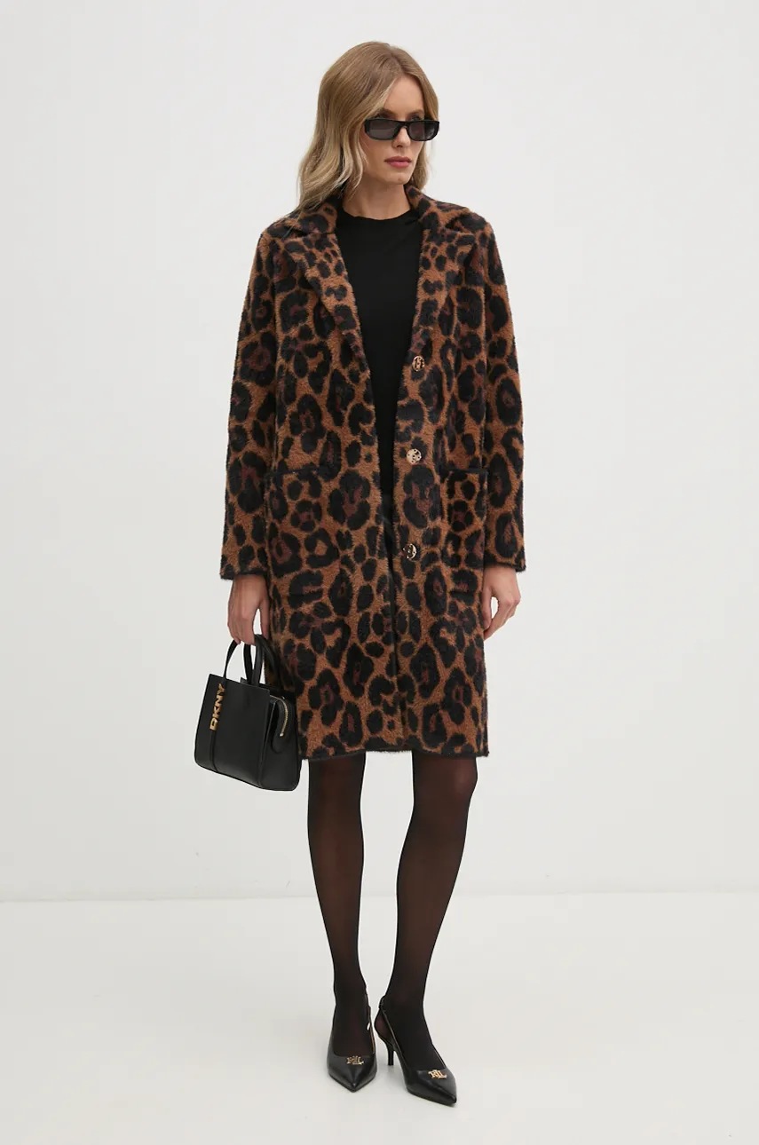 Δερμάτινη τσάντα Dkny χρώμα: μαύρο, R43EYG56 φωτογραφία