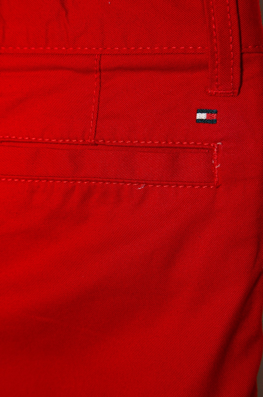 

Tommy Hilfiger - Дитячі шорти 92-176 cm