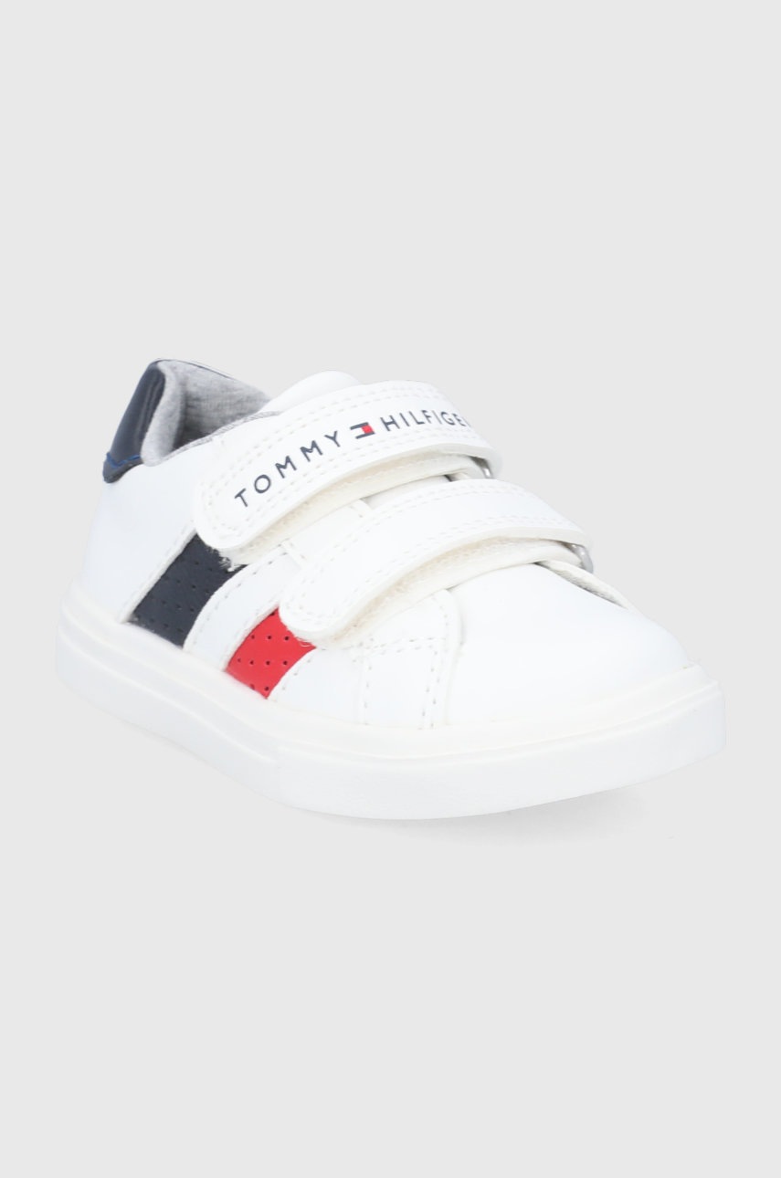 

Дитячі черевики Tommy Hilfiger колір білий