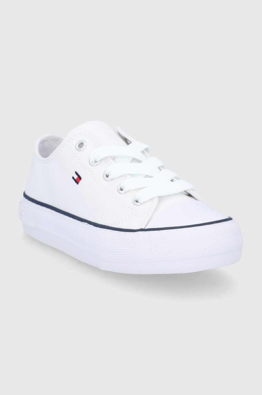 

Дитячі кеди Tommy Hilfiger колір білий