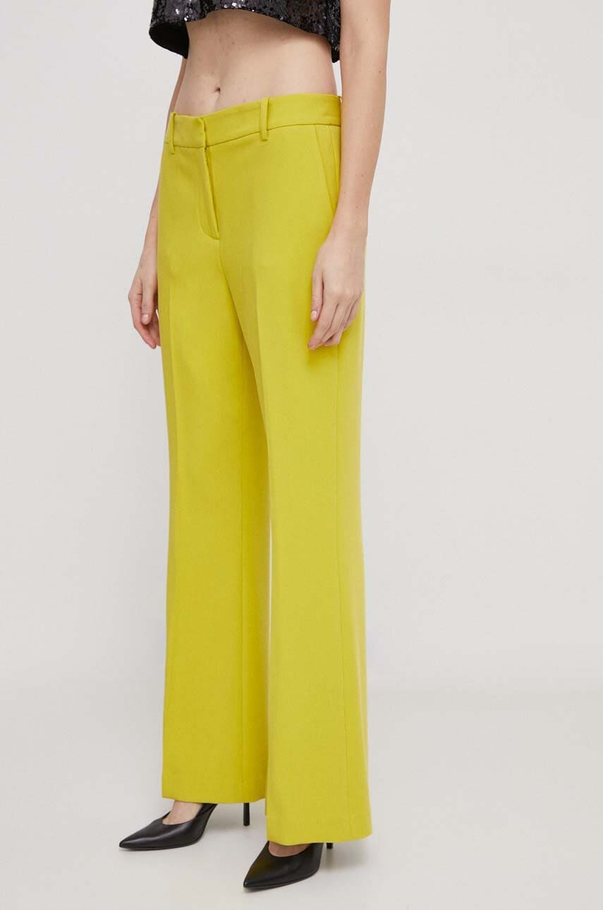 Levně Kalhoty Dkny dámské, žlutá barva, široké, high waist, UK3PX024